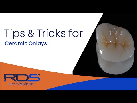 Tips And Tricks - Ceramic Onlays