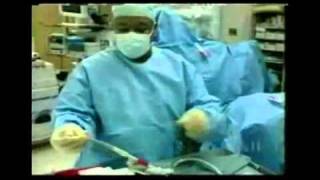 Minimally Invasive Heart Surgery - NBC11 HealthWatch