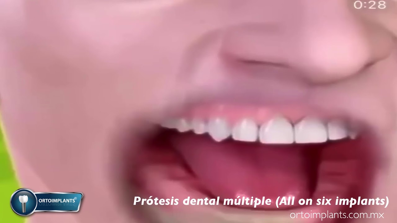 Javier Alejandro López García-58