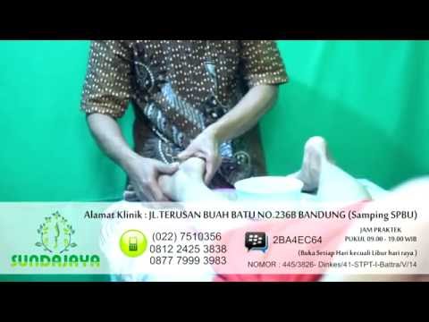 Bagaimana merangsang obat wanita Solusi impotensi