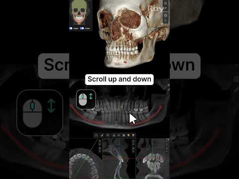 SMARTDent : 5D Tutorial #1-4. Basic Mouse Controls