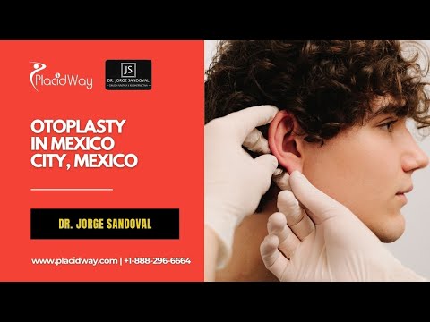 Otoplasty Mexico by Dr. Jorge Sandoval for Natural Ear Contours