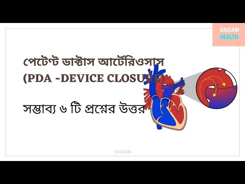পেটেন্ট ডাক্টাস আর্টেরিওসাস -৬ টি প্রায়শই জিজ্ঞাসিত প্রশ্ন