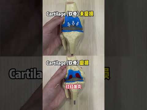 中老年人不吃药，也能缓解膝盖疼痛？MyGP Clinic Malaysia