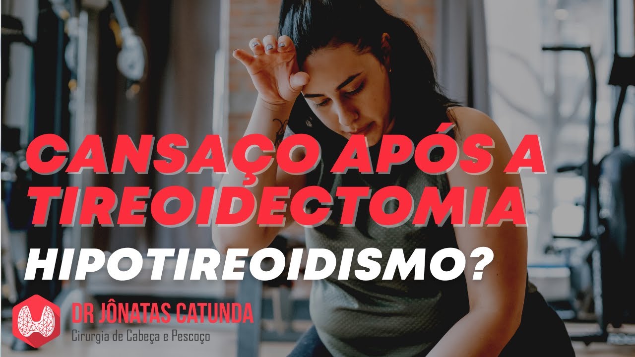 Cansaço constante após a tireoidectomia total - Hipotireoidismo?