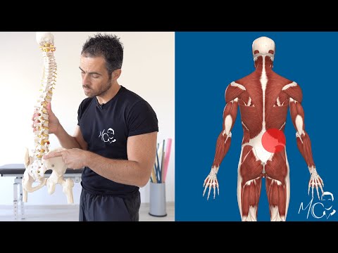 Dolore SCHIENA BASSA su un lato (dx o sx): ecco la causa più comune