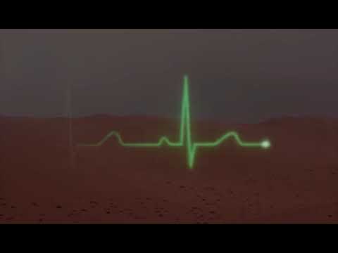 Videoclip de Feed Me (Live) — Wire