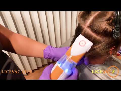 How to Use a Licevac Capture Nets to remove Head Lice : Licevac