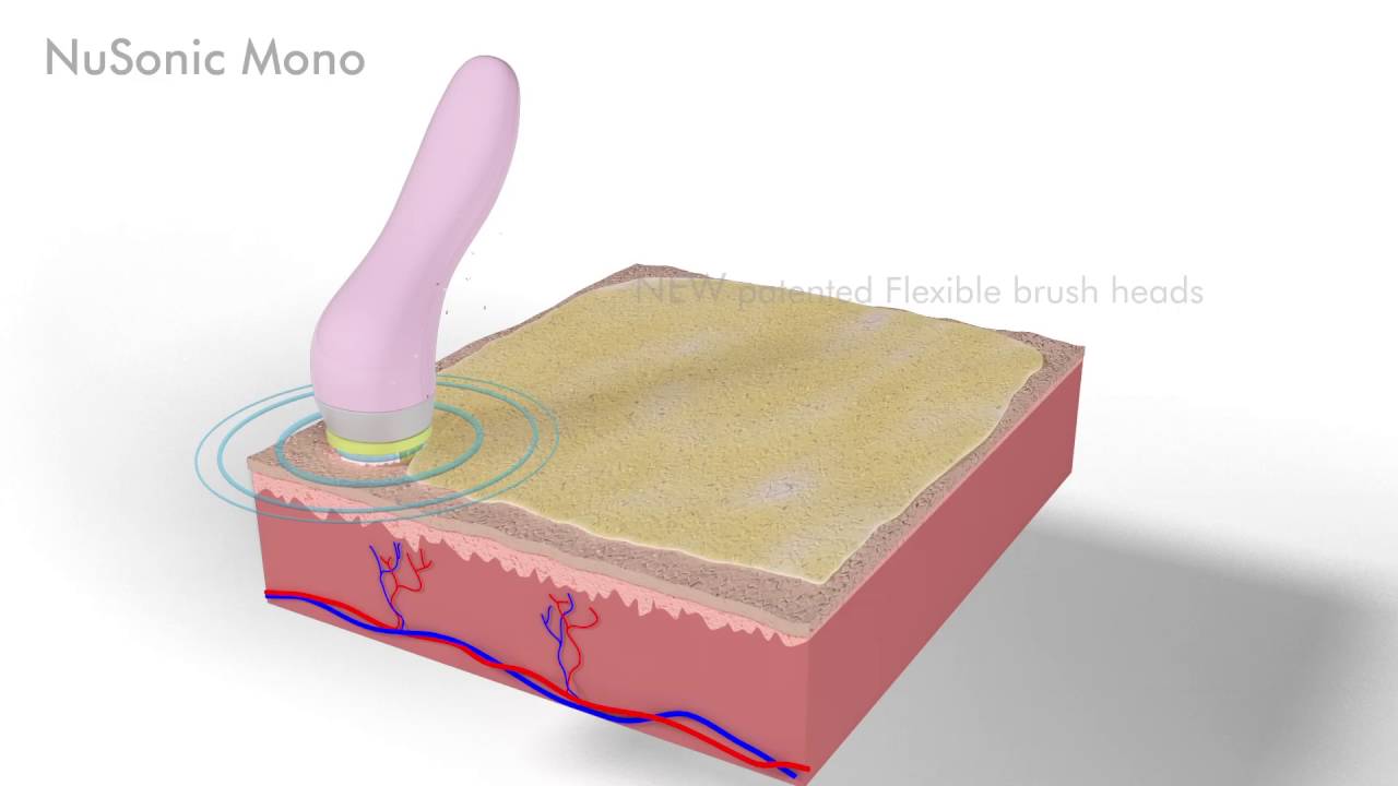 NuSonic