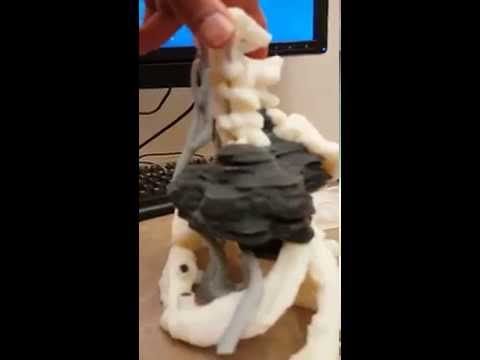 Schmerzen im Nacken zu tun Fieber Osteochondrose