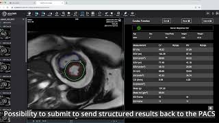 MedDream DICOM Viewer integrated with AI4CMR WebEditor for cardiac imaging using AI