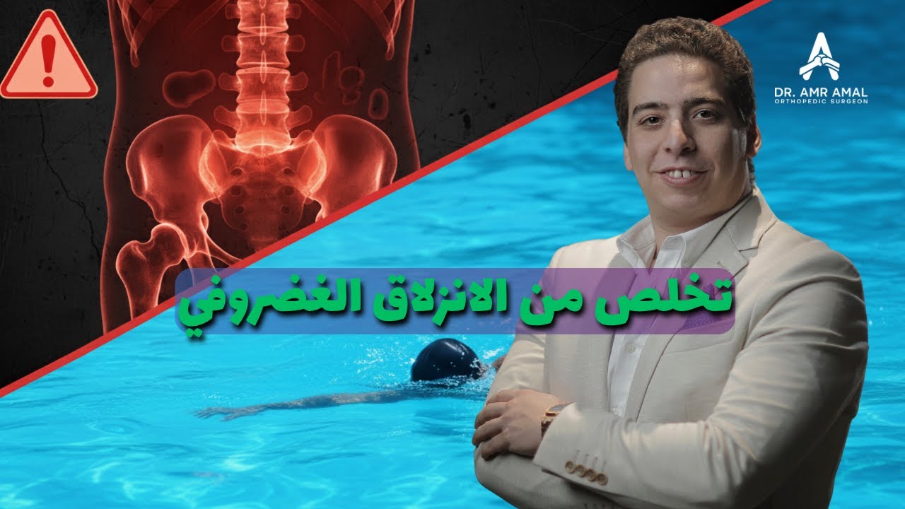 فيديو توضيحي عن جراحات العظام