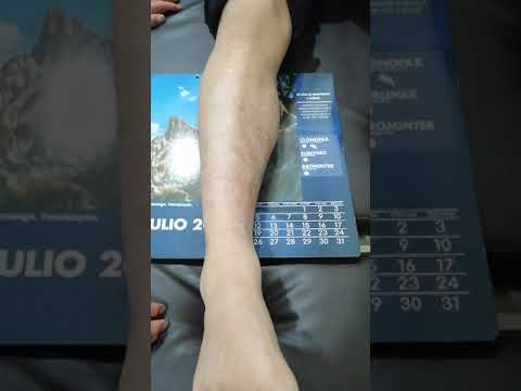 Radiografía de pierna