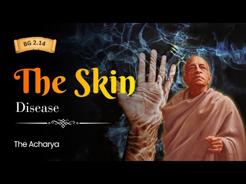 The Skin Disease | BG 2.14 | London, England | Srila Prabhupada