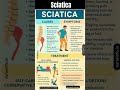 Sciatica - Causes and Symptoms #sciatica