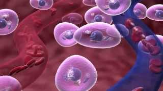 Deep Tissue | Laser Therapy | #1 | Expert | Michael Tomlinson | Sciatica | Pain Relief |Natural|HL4B