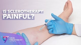 Is Sclerotherapy Painful?