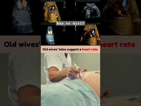 Boy or Girl? Fetal Heart Rate 148 bpm 🥰 #genderreveal #boyorgirl #gender #share