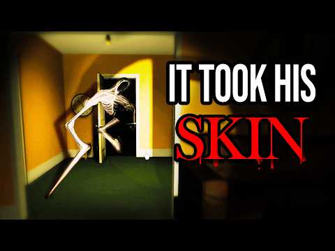 My friend came over, but his voice sounded different... [Amber Alert #2]