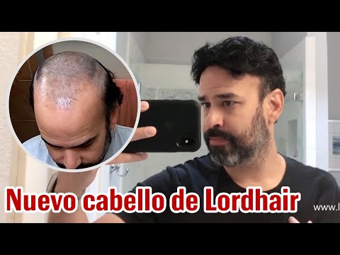 Nuevo cabello de Lordhair | Sistemas capilares personalizados para hombres