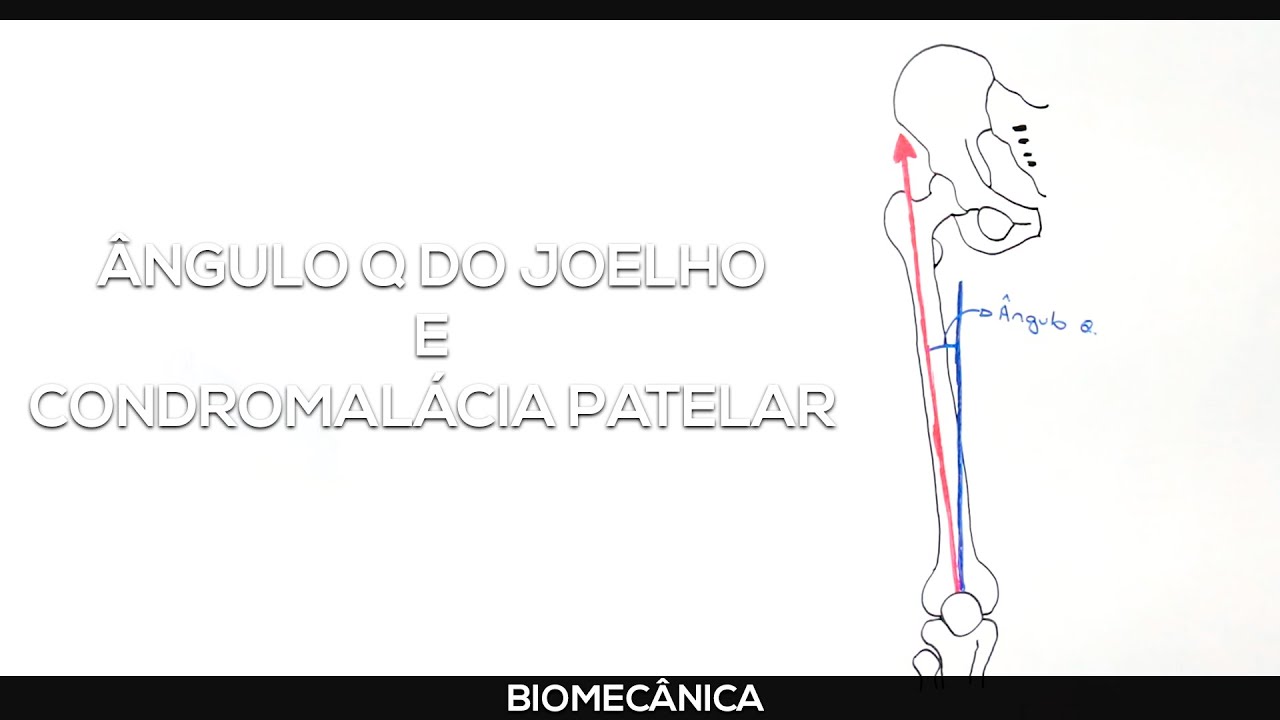 Ângulo Q do joelho e condromalacia patelar.