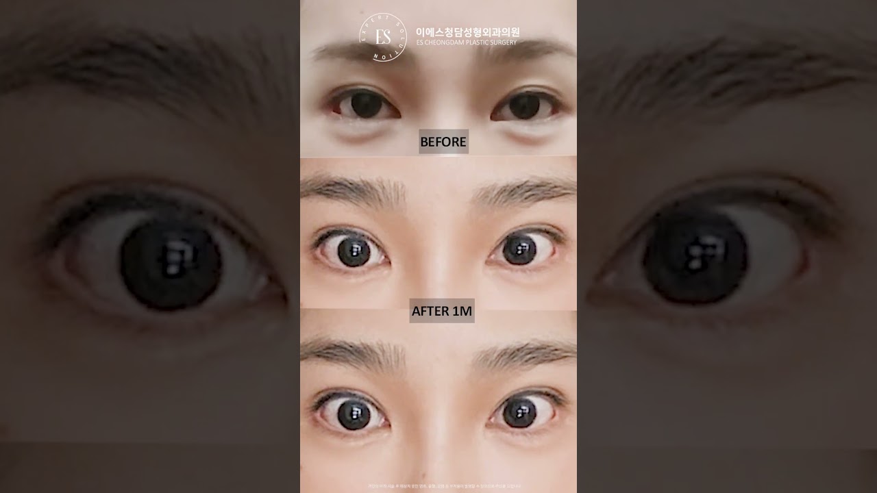 이에스 유튜브