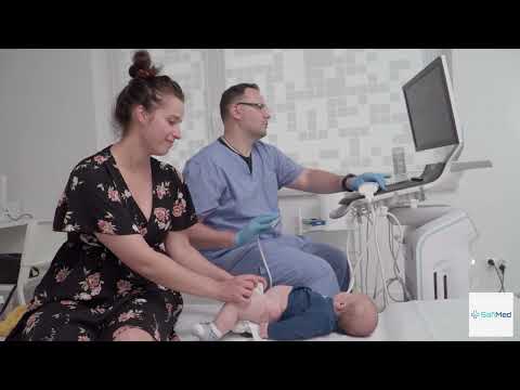 USG stawów biodrowych u niemowląt