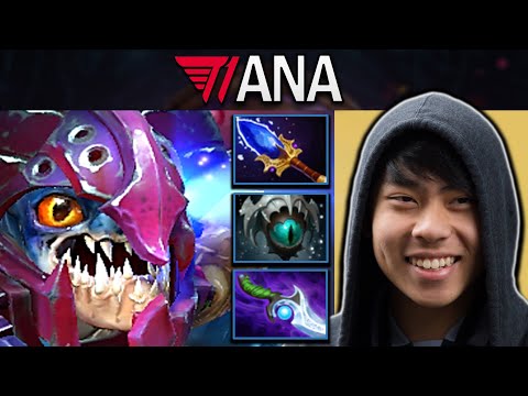 Slark Dota 2 Gameplay T1.Ana with Diffusal and Aghanims - Basher #dota2 #dota2gameplay
