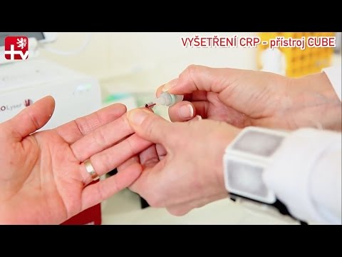 Maski drożdżowe opinii Forum włosów Skóra i olej z pestek winogron włosy