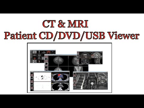YouTube video about: How to view mri cd on dvd player?