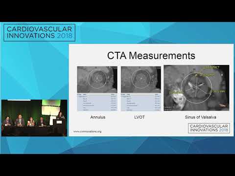 CVI2018 Session: The Boundaries of Structural Heart Therapy - II (Mt. Sopris, July 27, 10:30 am)