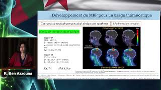 AICONM24 - La Radiopharmacie à l'ère de la Théranostique : Généralités (R. BEN AZZOUNA)