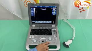 Full digital PC-based 3D/4D ultrasound