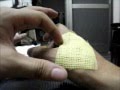 2nd Degree Burn Wound Bandage 