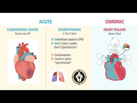 MI | Complications (Heart Failure & V Tach)