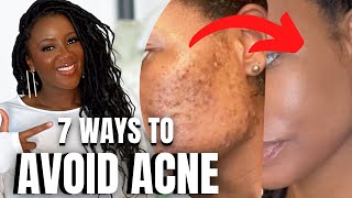 AVOID Acne & the Dark Spots They Cause (Black Skin Care)