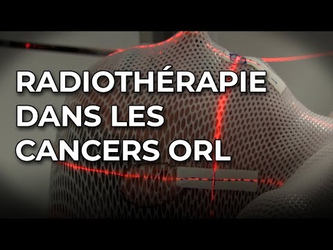 Radiotherapy in the management of ENT cancers