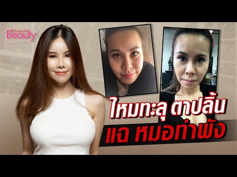 ร้อยไหม หน้าเรียว