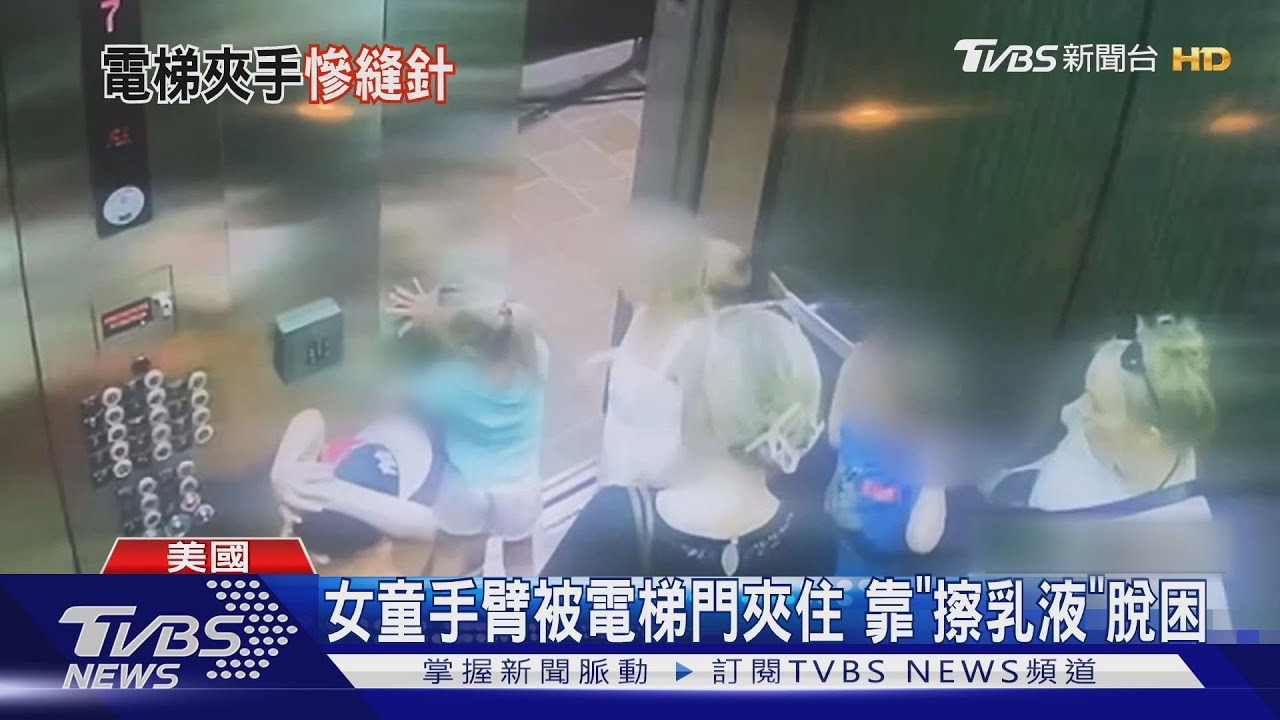 恐怖!美國女童手臂被電梯門夾住 靠「擦乳液」脫困