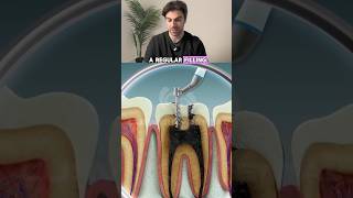 Root Canal Treatment Explained