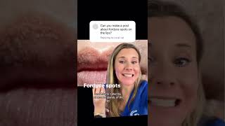 Curious about these little spots on your lips #fordycespots #lips
