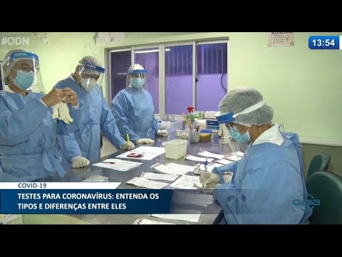 Testes para Coronavírus; entenda os tipos e diferenças entre eles 23 04 2021