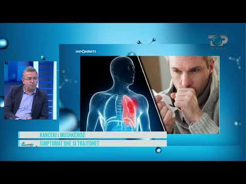 Hipokrati – Shenjat e kancerit të mushkërive, alarmante situata!