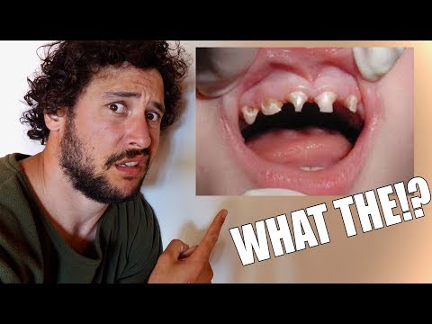 Toddlers and sugar don't mix