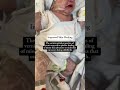 STOP Bathing Baby After Birth 3 Reasons Why