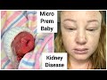 My Birth Story | PART 1- Finding out I have Kidney Disease at 20 weeks Pregnant | Makeupmejordyn