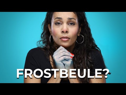 5 Tipps gegen kalte Hände und Füße