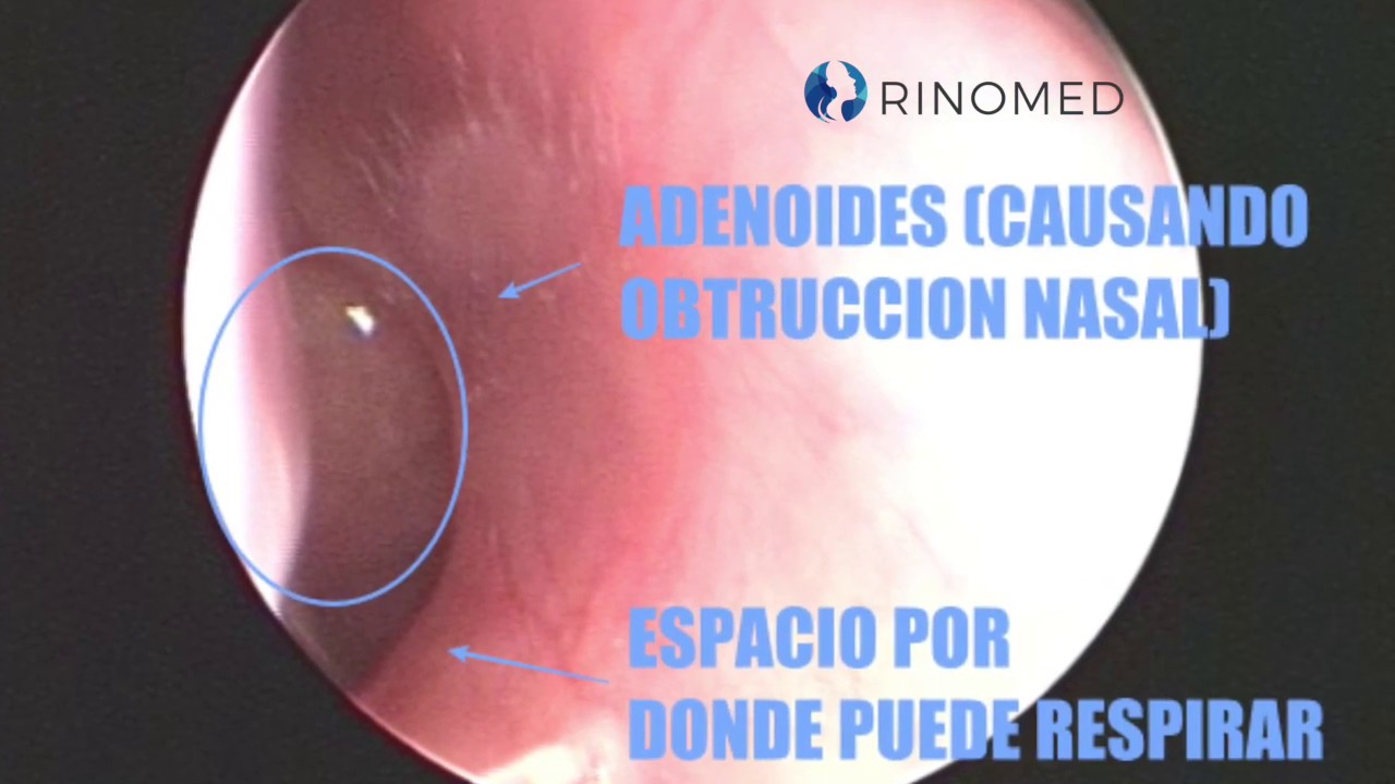 Lino Lara Solórzano-9