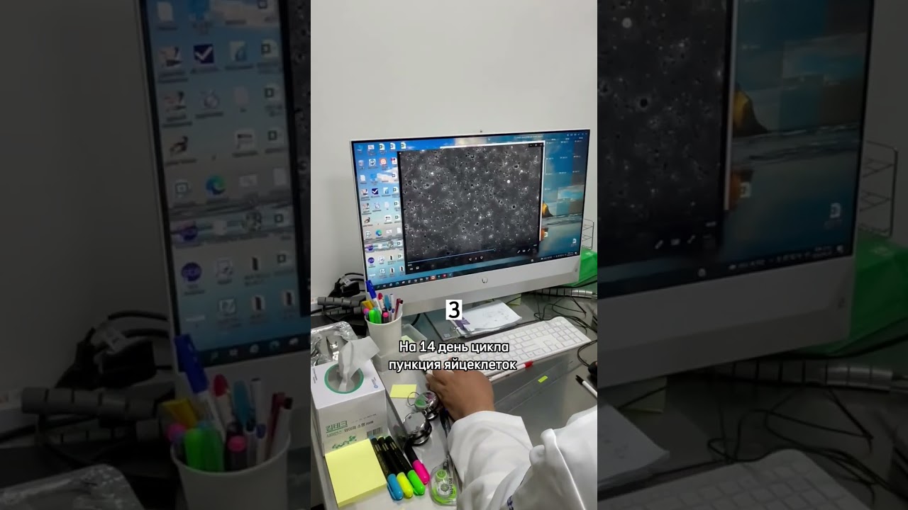 Этапы ЭКО #shorts