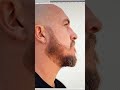 How To Style A Patchy Beard Where Do You Have Beard Patches Shorts